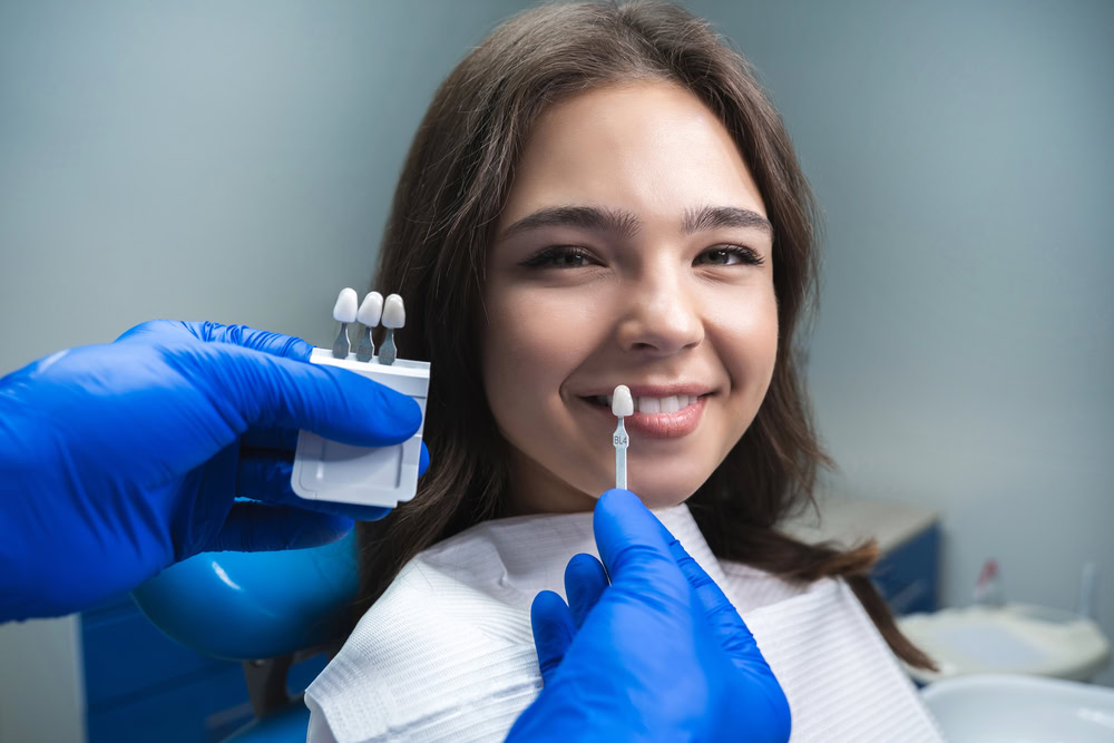 Porcelain vs Composite Veneers